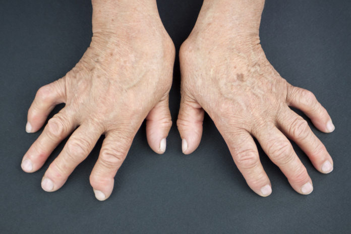 Rheumatoide Arthritis