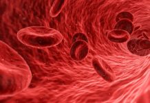 Was ist Antiphospholipid-Syndrom - Rote Blutkörperchen Erythrozyten in der Blutbahn