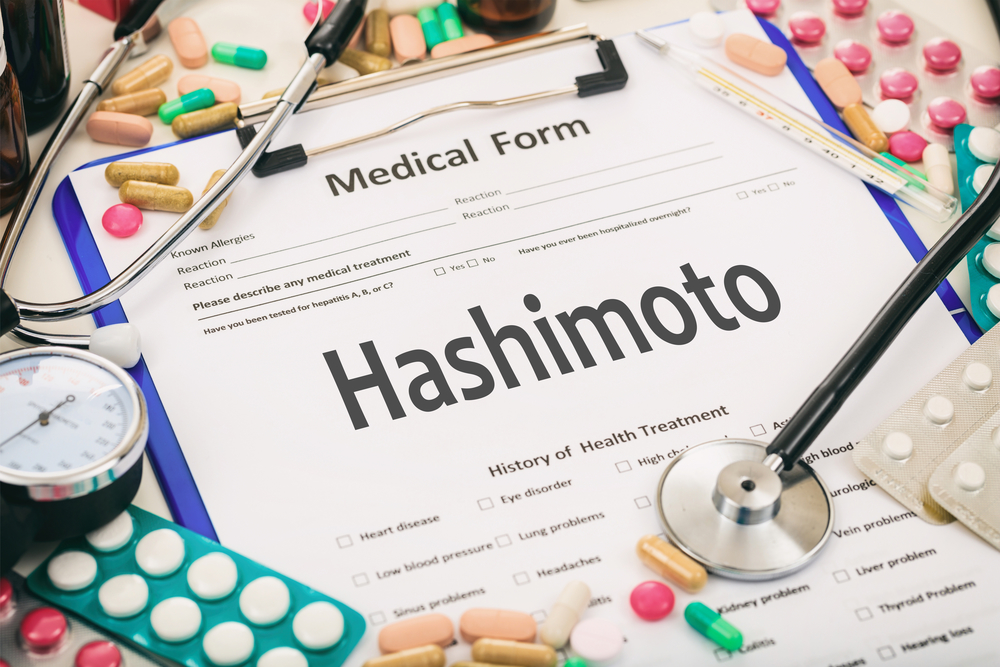 Was bedeutet Hashimoto?