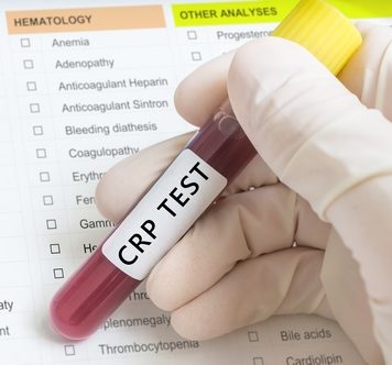 CRP-Wert Entzündung Infektion