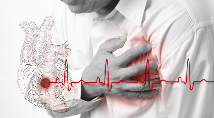 Herzinfarkt, Autoimmunerkrankungen