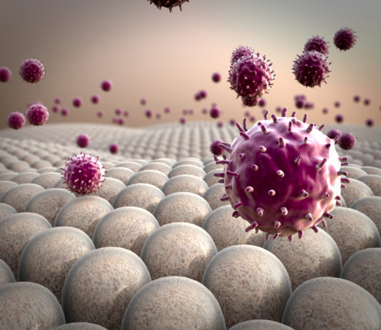 Immunzellen, Multiple Sklerose