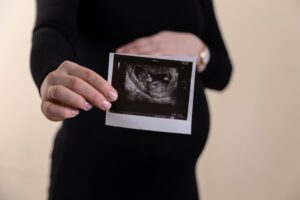 Eine schwangere Frau hält ein Foto ihres Ultraschalls in der Hand.